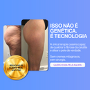 Ionique Velora | Terapia de Contorno Anticelulite | Portátil com Ventosas e Ação Térmica