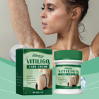 Vitiligo Repair Cream | Natural Plant Extracts | Pigment Correction & Deep Moisturizing | For Sensitive Skin