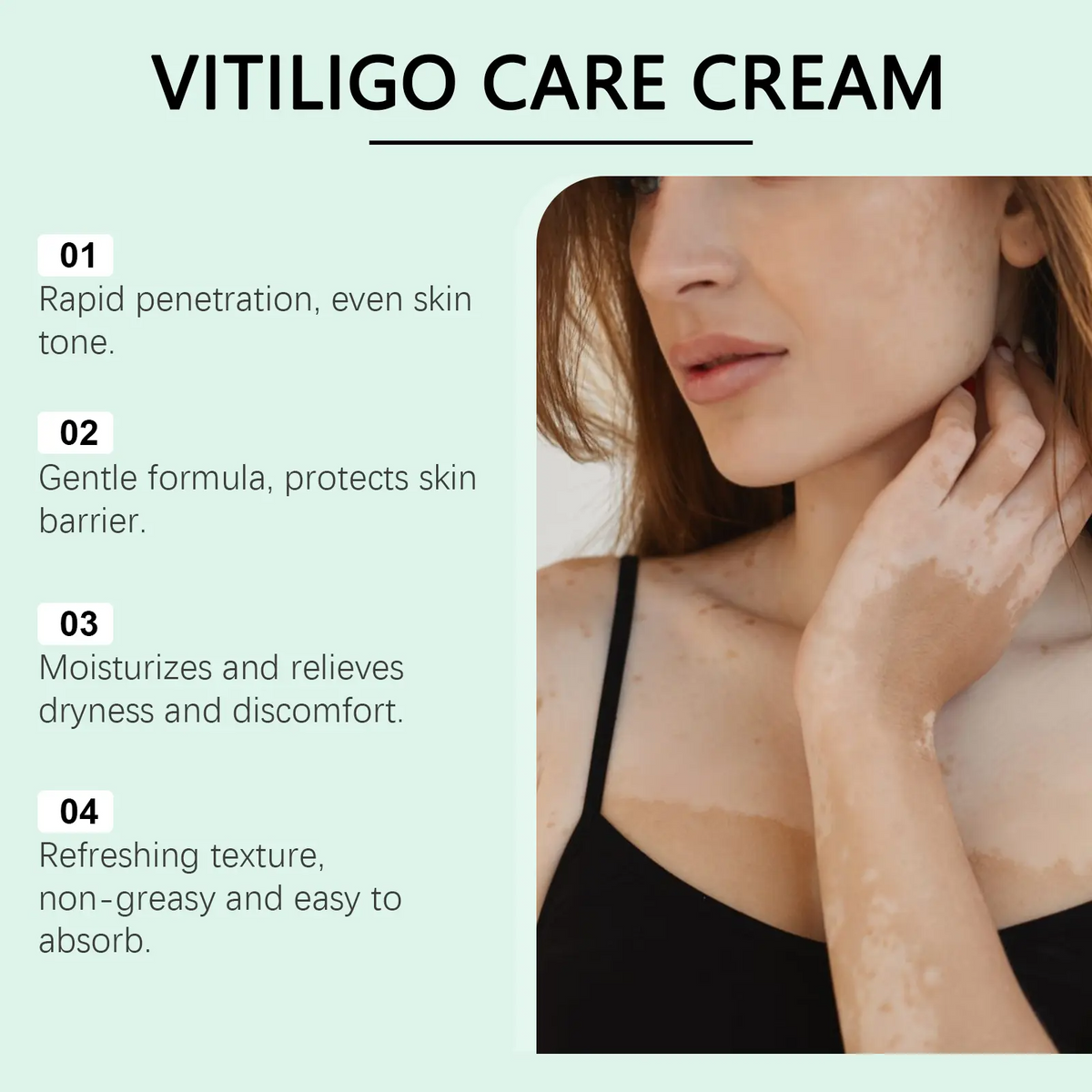 Vitiligo Repair Cream | Natural Plant Extracts | Pigment Correction & Deep Moisturizing | For Sensitive Skin