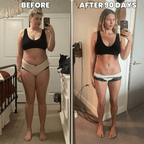 Thyroid Support