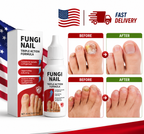 Fungi Nail Anti-Fungal Liquid Herbal Extracts Toenail Fungus Treatment Safe Us Serenzza