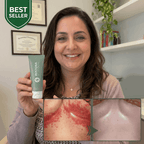 Restora™ Relief Cream - Skin Fold Rash Treatment