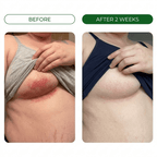 Restora™ Relief Cream - Skin Fold Rash Treatment