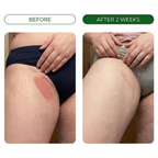 Restora™ Relief Cream - Skin Fold Rash Treatment