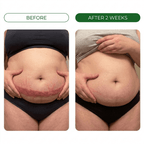 Restora™ Relief Cream - Skin Fold Rash Treatment