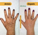 Spray- 577 Remove manchas de SOL, IDADE E MELASMA! 50% DE DESCONTO + FRETE GRÁTIS!