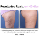 Ionique Velora | Terapia de Contorno Anticelulite | Portátil com Ventosas e Ação Térmica