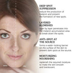 Premium Niacinamide + Vitamin Cream - Dark Spot & hyperpigmentation Corrector