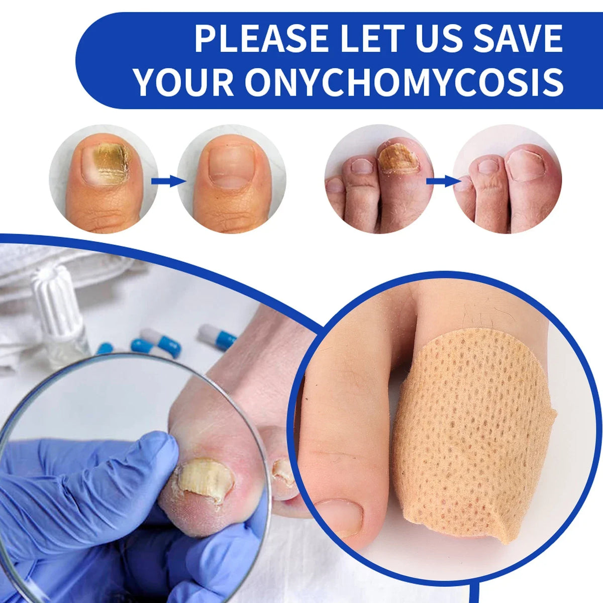BUY 1 GET 3 – 21pcs Waterproof Toenail Fungus Repair Patches Serenzza