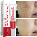 Premium Niacinamide + Vitamin Cream - Dark Spot & hyperpigmentation Corrector