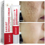 Premium Niacinamide + Vitamin Cream - Dark Spot & hyperpigmentation Corrector