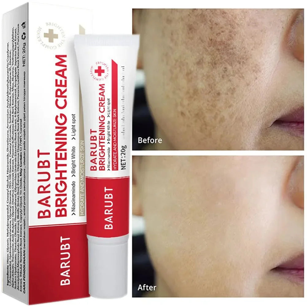 Premium Niacinamide + Vitamin Cream - Dark Spot & hyperpigmentation Corrector