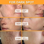 Premium Niacinamide + Vitamin Cream - Dark Spot & hyperpigmentation Corrector