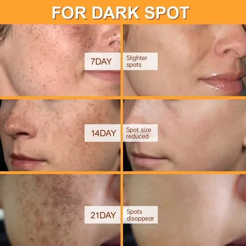 Premium Niacinamide + Vitamin Cream - Dark Spot & hyperpigmentation Corrector