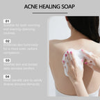 Bacne out Bar Acne Control Soap