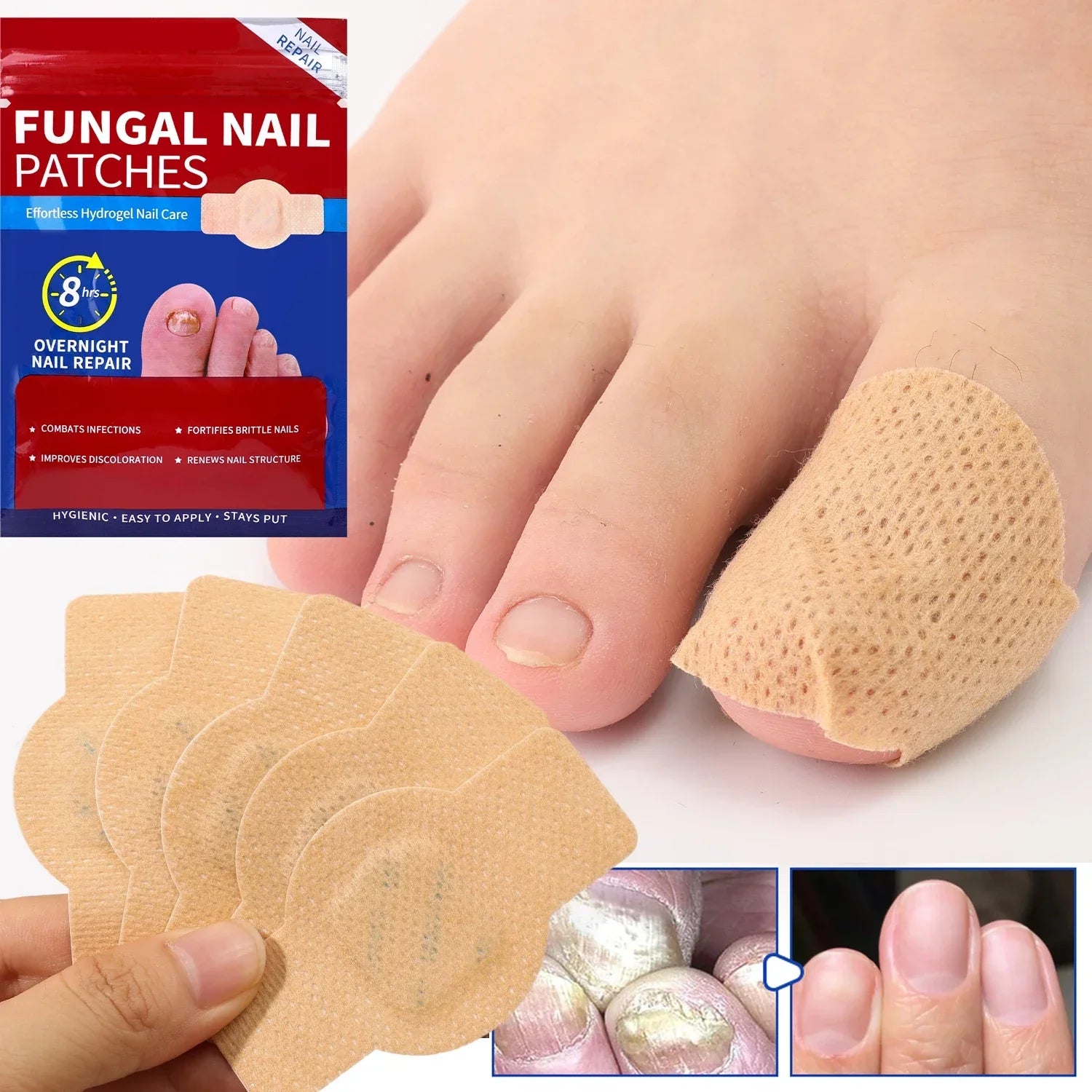 BUY 1 GET 3 – 21pcs Waterproof Toenail Fungus Repair Patches Serenzza