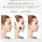 Smart Face Sculpting Device - 8 Modes Double Chin Reducer & Jawline Definer