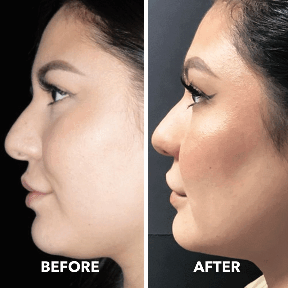 Smart Face Sculpting Device - 8 Modes Double Chin Reducer & Jawline Definer