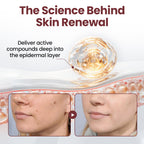KeraErase Dual-Action Renewal Cream