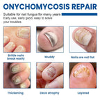 60 Pcs - Extra Strength Fungal Nail Patches, 60 Pcs Toenail Treatment for Nail Care
