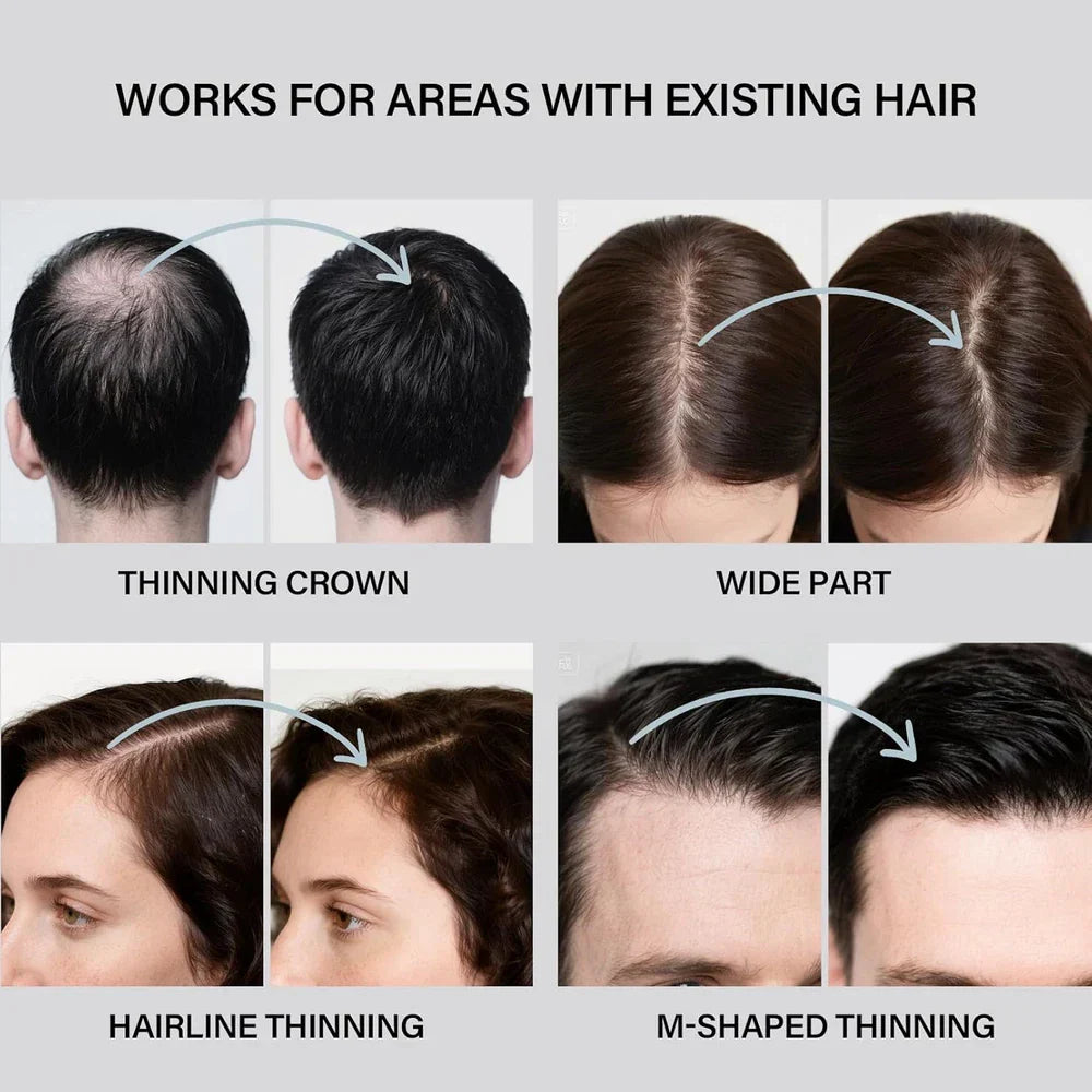 Hair Building Fibers for Thinning Hair for Men Women, 2-In-1 Kit- Enhancements B