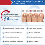 60 Pcs - Extra Strength Fungal Nail Patches, 60 Pcs Toenail Treatment for Nail Care
