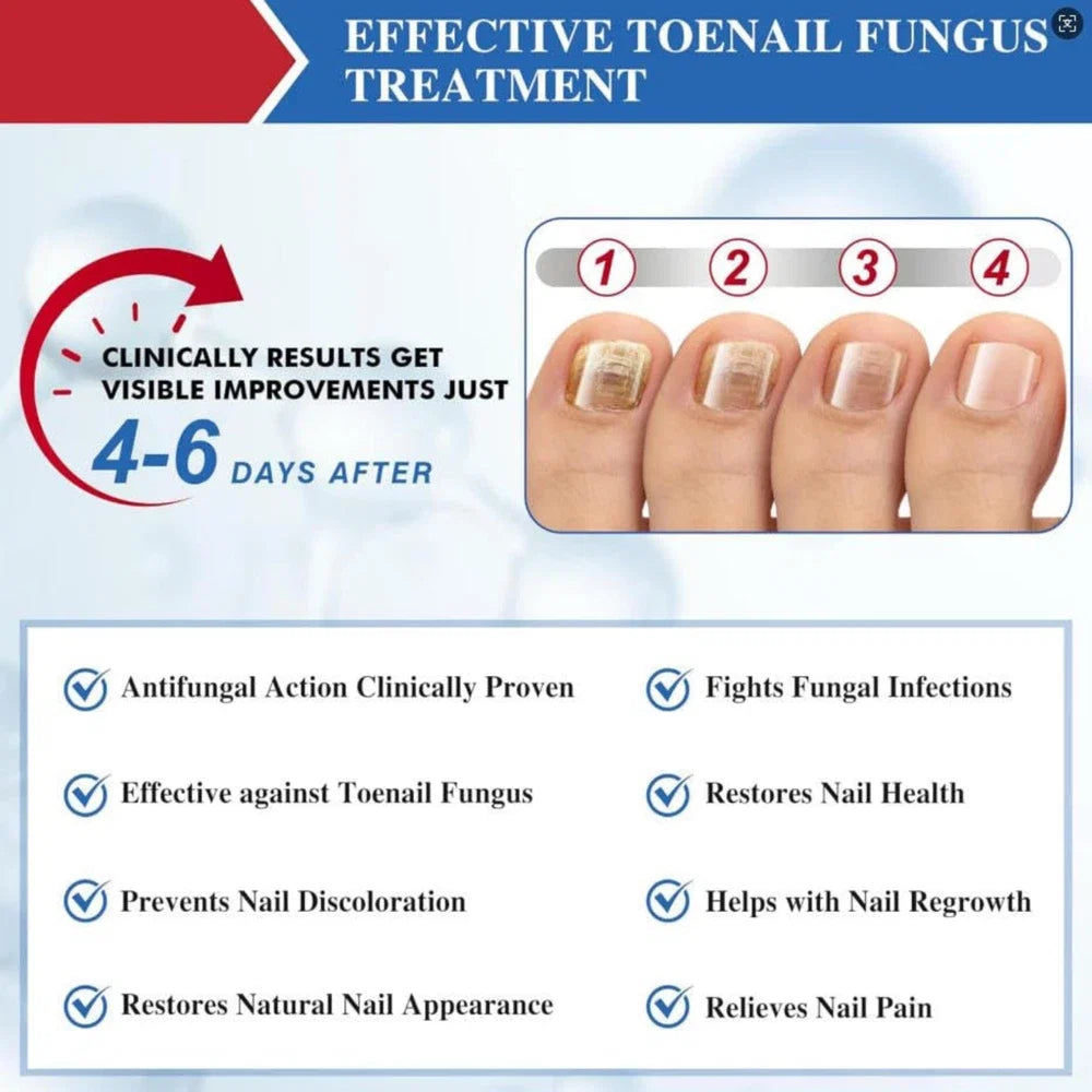60 Pcs - Extra Strength Fungal Nail Patches, 60 Pcs Toenail Treatment for Nail Care