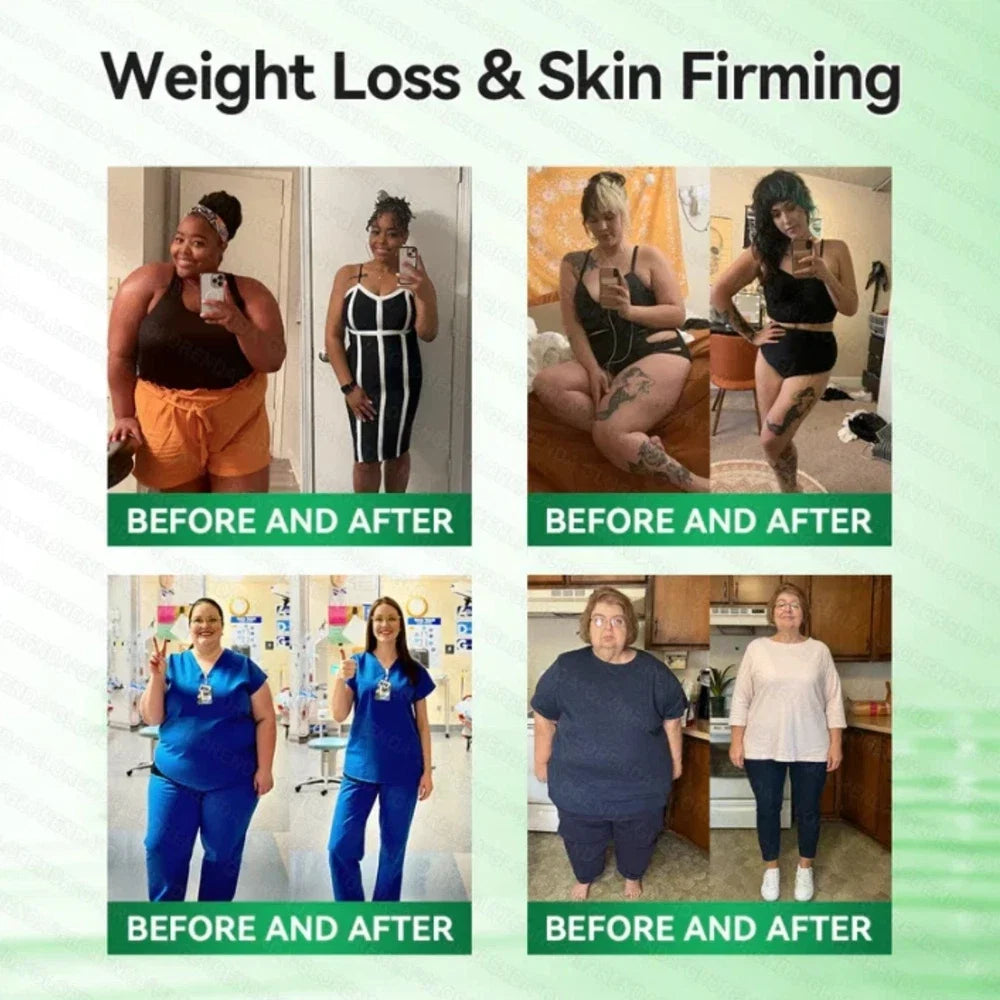(BUY 1 GET 3) 1-5Boxes Moringa Berberine NAD+ Weight Loss Patches Advanced Nano Microneedle Serenzza