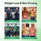 (BUY 1 GET 3) 1-5Boxes Moringa Berberine NAD+ Weight Loss Patches Advanced Nano Microneedle Serenzza