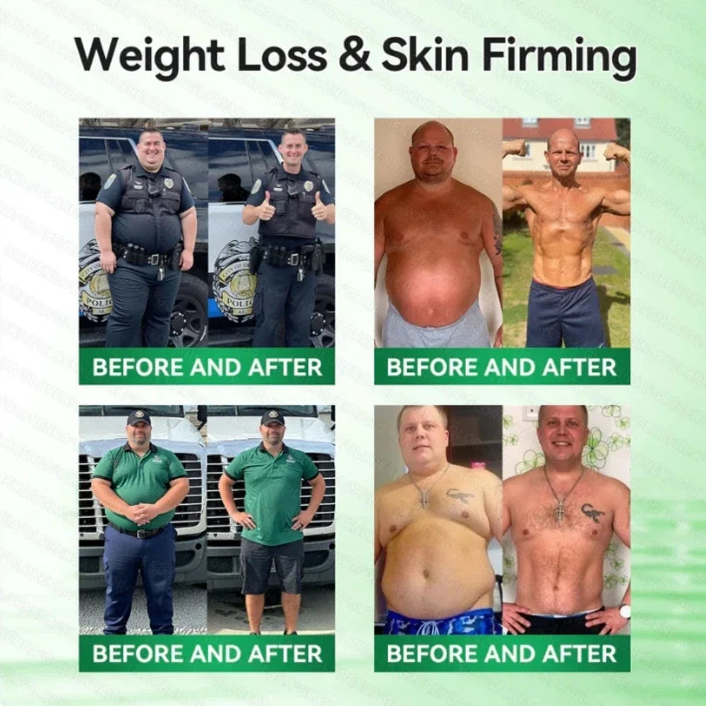 (BUY 1 GET 3) 1-5Boxes Moringa Berberine NAD+ Weight Loss Patches Advanced Nano Microneedle Serenzza