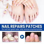 60 Pcs - Extra Strength Fungal Nail Patches, 60 Pcs Toenail Treatment for Nail Care